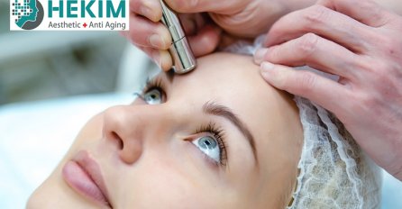 DIJAMANTNA MIKRODERMOABRAZIJA - Nova dimenzija savršene njege kože!