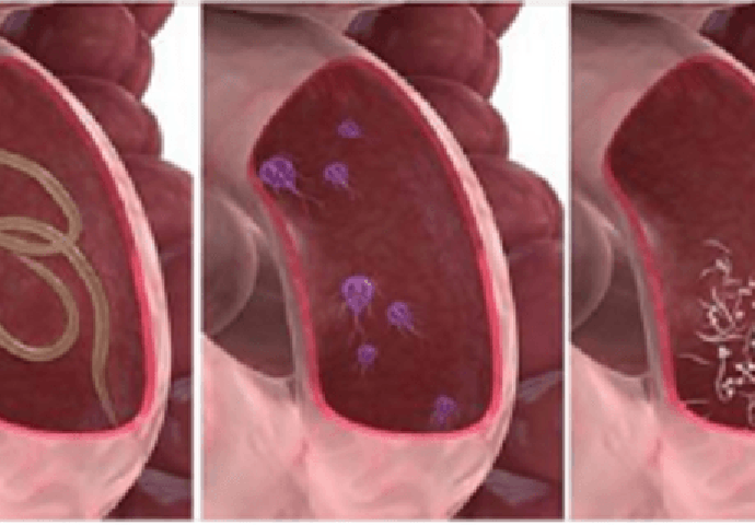 NAPALI SU VAM CRIJEVA: Ovi znakovi ukazuju na PARAZITE U STOLICI, reagujte dok nije kasno!