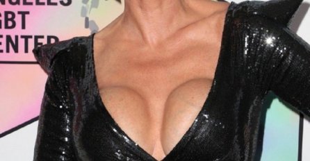 SILIKONI JOJ SE RASPADAJU, A HALJINA JE UŽAS: Ovo nije jedina skandalozna fotografija, čekajte da vidite ostale! 