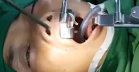 DVA MJESECA GA JE MUČIO STRAŠAN KAŠALJ: Kada je otišao kod ljekara, iz GRLA SU IZVADILI NEŠTO ODVRATNO!