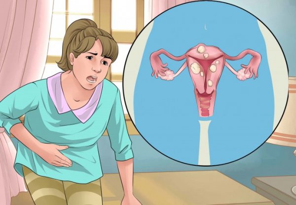 menstruacija