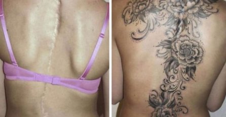 Oni su imali ogromne ožiljke na tijelu: A onda su odlučili da se istetoviraju! Evo kako sad izgledaju, broj 5 tjera suze na oči