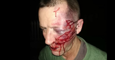 Haris je pretučen i opljačkan na putu do grada: Prevezen na UKC Tuzla na ukazivanje ljekarske pomoći