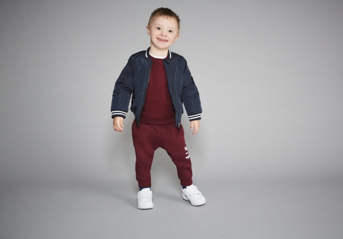 PRIČA KOJA OSVAJA SRCA! Maneken sa down sindromom šarmira svakog!