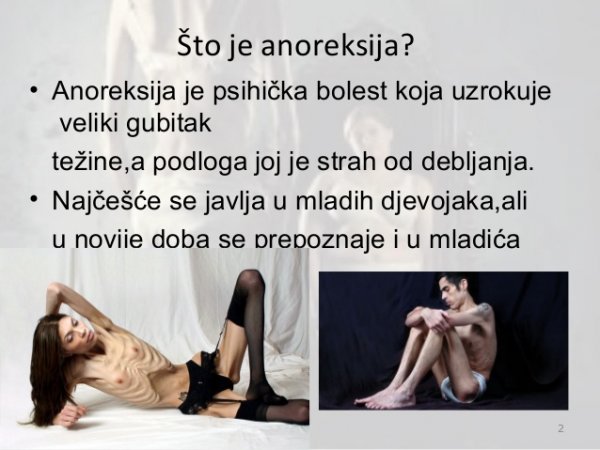 anoreksija-2-638