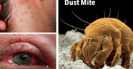 GRINJA I BAKTERIJA MOŽETE SE RIJEŠITI NA SAMO JEDAN NAČIN: Dobro je da znate ovo, DIJELITE DALJE