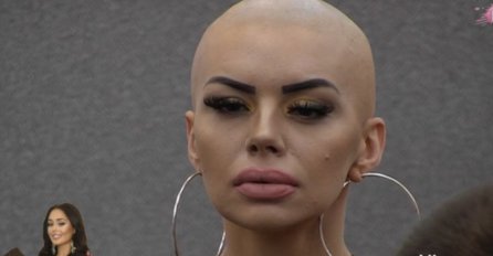 ZBOG NJEG JE ZERINA HEĆO OBRIJALA GLAVU U ZADRUZI, A EVO ŠTA SE DESILO S NJIM: Objavljene najnovije slike (FOTO)