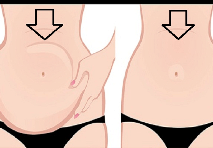 IZBACITE JE HITNO, 1 NAMIRNICA JE GLAVNI UZROK DEBLJINE: Stvara masnoću na stomaku i ugrožava zdravlje