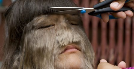 PRONAŠLA JE MOMKA I PRVI PUT OBRIJALA SVOJE LICE: Ovako danas izgleda najdlakavija djevojka na svijetu (FOTO)