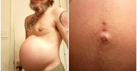 Svi su mi govorili da NEMA ŠANSE DA ZATRUDNIM: Počele su jutarnje mučnine i USKORO SE DESILA STVAR ZBOG KOJE ME MRZI CIJELI GRAD