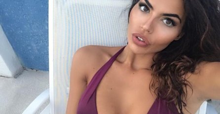 Manekenka pokazala BRADAVICE, ali i još nešto! Sve se vidi: Muškarcima neće biti dobro kad vide DONJI DIO, nije za one slabog srca