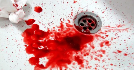 Djevojka namjerno odrezala svoju ruku: Lažirala nesreću, a tek onda je uslijedio šok