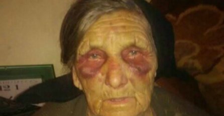 JEZIVO, PREVRNULI JOJ CIJELU KUĆU, A ONDA JE NAPALI KAO ZVIJER:  Baku  razbojnici brutalno pretukli zato što nije imala pare