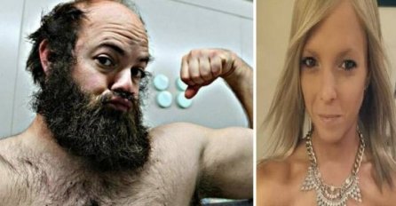 DA SE NAJEŽIŠ: Ostat ćete BEZ KOMENTARA kada vidite prije i poslije fotografije ljudi koji su uz pomoć operacija promijenili spol