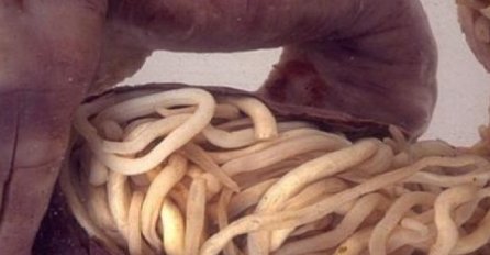 AKO OSJEĆATE OVE SIMPTOME, VAŠA CRIJEVA SU PUNA PARAZITA: Možete ih ukloniti brzo s ovom namirnicom 