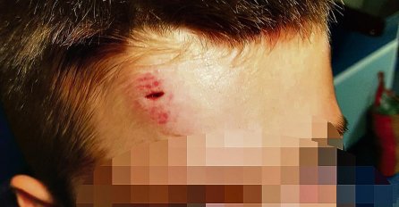 HOROR U SRBIJI! Motikom silovali dječaka (10) u školskom dvorištu: Bacali ga u blato i snimali telefonom!