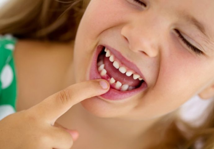 Ako vaše dijete slomi ili izbije zub: Evo šta trebate uraditi