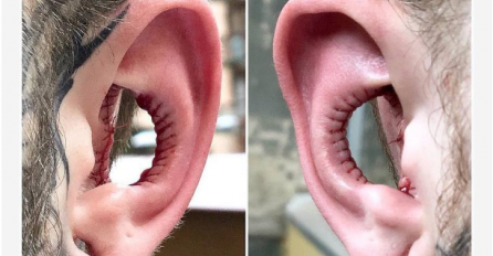 KAKVA JE OVO MODA?! Bizarne modifikacije tijela koje će vas zapreprastiti, a tek kad vidite ostale