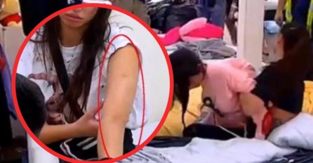 MODRICE PO TIJELU, PLJUVALA KRV, ISPAO JOJ I ZUB: Objavljene slike nakon Krunićkinog prebijanja, LEDE KRV U ŽILAMA 