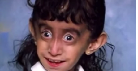 Govorili su joj da je ODVRATNA i da je NAJRUŽNIJA djevojčica na svijetu, 25 godina kasnije ona izgleda ovako i svima je ZAPUŠILA USTA 