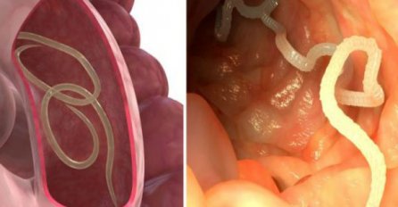 RIJEŠITE SE PARAZITA IZ TIJELA I NORMALIZUJTE KILAŽU: Trebaju vam samo 2 namirnice za ovaj narodni recept!