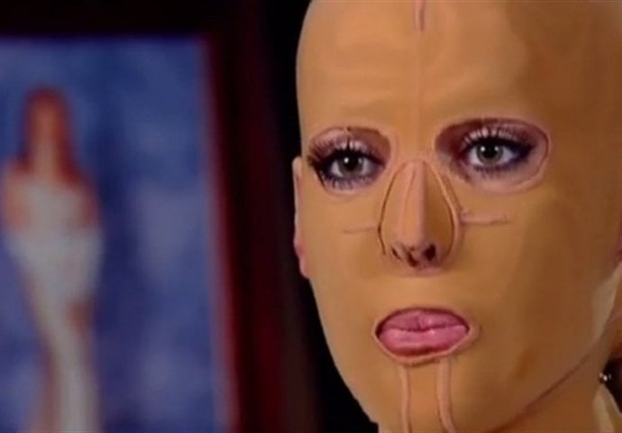 LJUBOMORNA ŽENA JE ŽIVU SPALILA: Nosila masku 3 godine, imala 200 operacija, a EVO KAKO DANAS IZGLEDA!