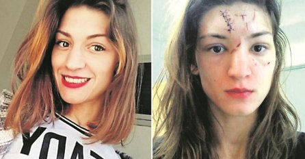 UNAKAZIO LICE SVOJE DJEVOJKE: Razbio mi je čašu na čelu i rekao da će me ubiti ako to ikome kažem!