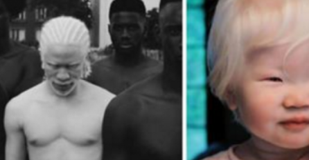 NJIHOVA LJEPOTA ODUZIMA DAH: Očaravajuće fotografije ALBINO LJUDI, koje će vas apsolutno HIPNOTISATI! 