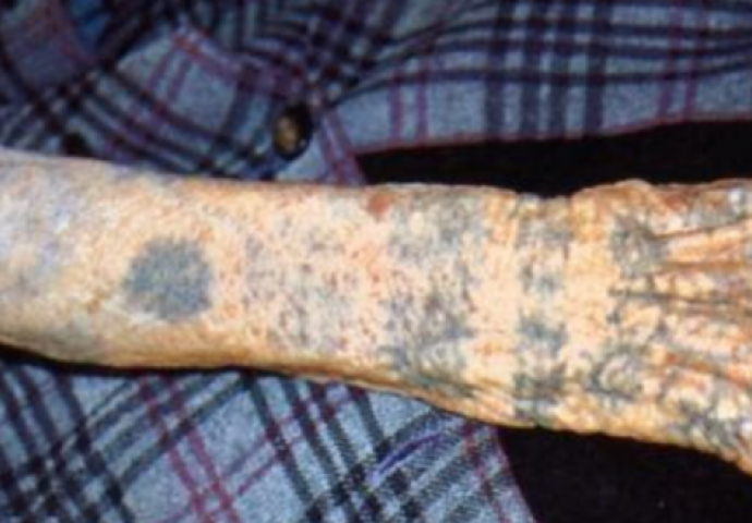 ŽELITE URADITI TETOVAŽU? Predomislit ćete se kad vidite kako izgledaju u starosti (FOTO)