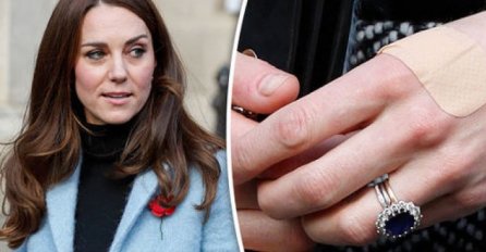 DA LI STE PRIMIJETILI DA KATE MIDDLETON UVIJEK NOSI FLASTERE NA PRSTIMA? Bićete zapanjeni kada čujete pravi razlog za ovo (FOTO)