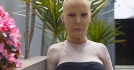 SRPKINJU ŽIVU SPALILA LJUBOMORNA ŽENA: Nosila masku 3 godine, imala 200 operacija, a evo kako danas izgleda  