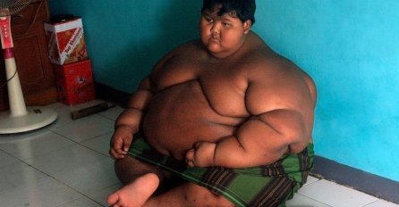 NAJDEBLJI DJEČAK NA SVIJETU OTIŠAO NA OPERACIJU: Izgubio je 82 kilograma, a kad ga vidite DANAS NEĆETE VJEROVATI SVOJIM OČIMA (FOTO)