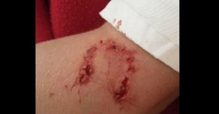 PROBUDIO GA JE KĆERKIN VAPAJ ZA POMOĆ USRED NOĆI: Sledio se kad je vidio ŠTA je na njenoj ruci!