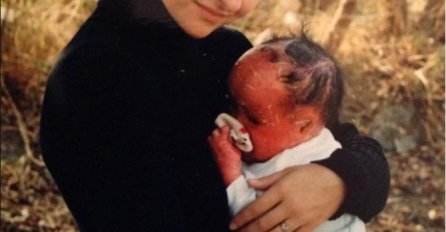 RODILA SE POTPUNO CRVENA, A MAJKA JU JE ODMAH NAPUSTILA: Evo kako izgleda 23 GODINE KASNIJE, nećete vjerovati svojim očima (FOTO)