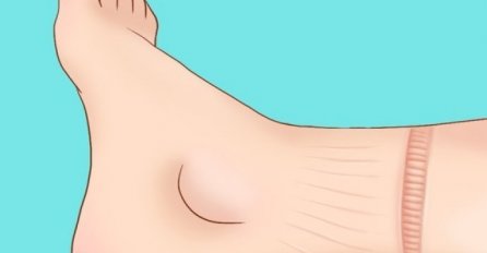 UPOZORAVAJUĆI ZNAKOVI DA VAŠE SRCE NE RADI KAKO TREBA: Posebno obratite pažnju na signal broj 3