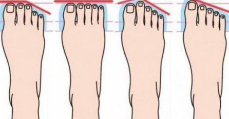 KAKVE SU VAM NOGE, TAKVI STE U SRCU: Oblik stopala otkriva ličnost do gole kože!