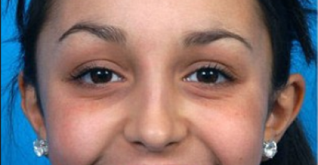 BILA JE RUŽNO PAČE, SVI SU JE ISMIJAVALI ZBOG ZUBA: Izmijenili su joj cijelu vilicu i SADA JE NEVIĐENA LJEPOTICA (FOTO)