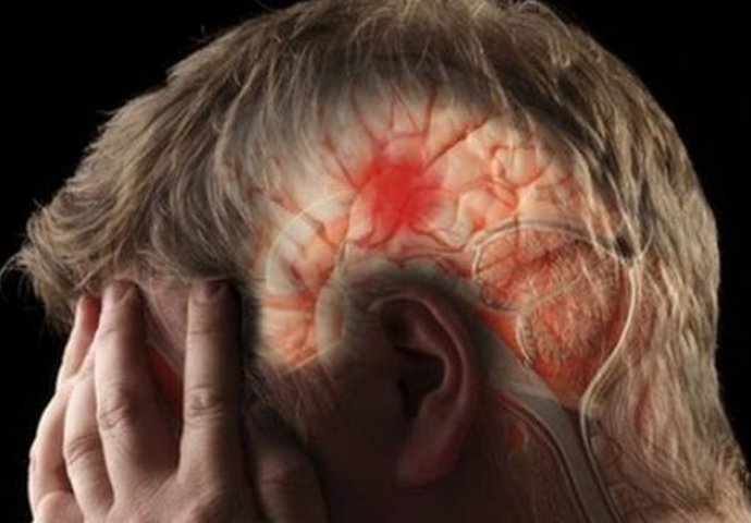 PRVA 3 SATA SU KLJUČNA - Ovo su prvi simptomi koji ukazuju na moždani: Ako se odmah javite ljekaru, možete se spasiti
