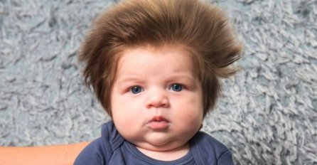 SJEĆATE SE BUJNE FRIZURE PRESLATKOG DJEČAKA? Sada je porastao, A TEK KAD VIDITE KAKO IZGLEDA! (FOTO)