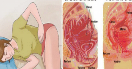 UPOZORENJE ŽENAMA: 1 od 10 žena pati od OVE podmukle bolesti i nemaju pojma o tome!