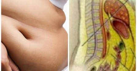 MUČI VAS STOLICA, 7 DANA NISTE IŠLI U WC: Uradite ovo i odmah ćete otrčati u kupatilo