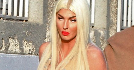 Jelena Karleuša u masnicama i podlivima FOTO