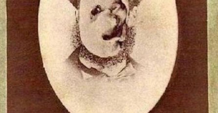 ŠTA STE PRVO UGLEDALI NA SLICI, AKO JE U PITANJU DEFORMISANO LICE GRIJEŠITE: Evo šta se nalazi na njoj, NJEŽNI PRIZOR!