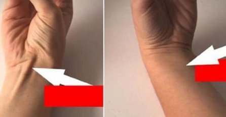 SPOJITE PALAC I MALI PRST: Ako vam se tada POJAVI IZBOČINA NA RUCI, ovo morate znati!