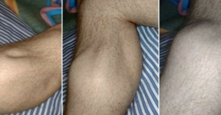 GRČEVI U LISTOVIMA SU OZBILJAN SIMPTOM: Evo na šta ukazuje ova bol, VAŽNO DA ZNATE