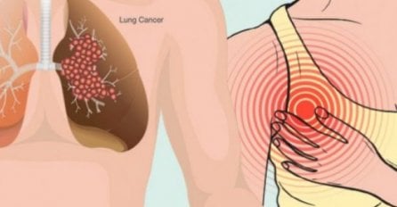 KAŠALJ NIJE PRVI SIMPTOM RAKA PLUĆA, NEGO OVO: Ako ih učite, odmah doktoru!