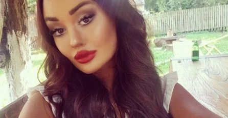 UŽAS, ŠTA JOJ SE OVO DESILO: Nakon 10 mjeseci, EVO ŠTA JE ŠMINKA URADILA ANINOM LICU, kad su je snimili IZBLIZA ZGROZILI SU SE (VIDEO)