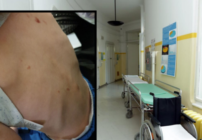 U BOLNICU DOVELA DJEČAKA S LOMOVIMA I OŽILJCIMA OD ČIKOVA