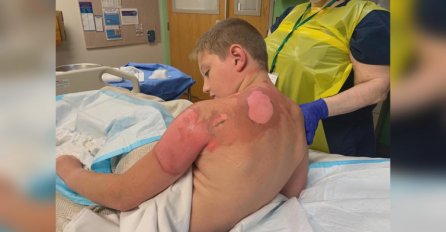 NOVI SULUDI IZAZOV U AMERICI:  Djeca se snimaju dok piju i dok se polijevaju ključalom vodom ! NEKOLIKO POVRIJEĐENIH, JEDNO UMRLO!