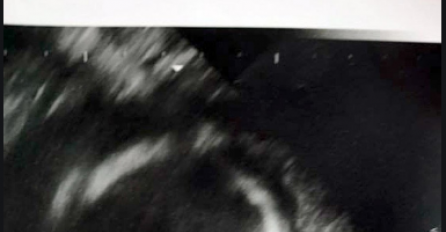 OTIŠLA SAM U 21. SEDMICI TRUDNOĆE NA ULTRAZVUK: Kad sam vidjela sliku svog djeteta, POŽELJELA SAM DA SE NE PORODIM